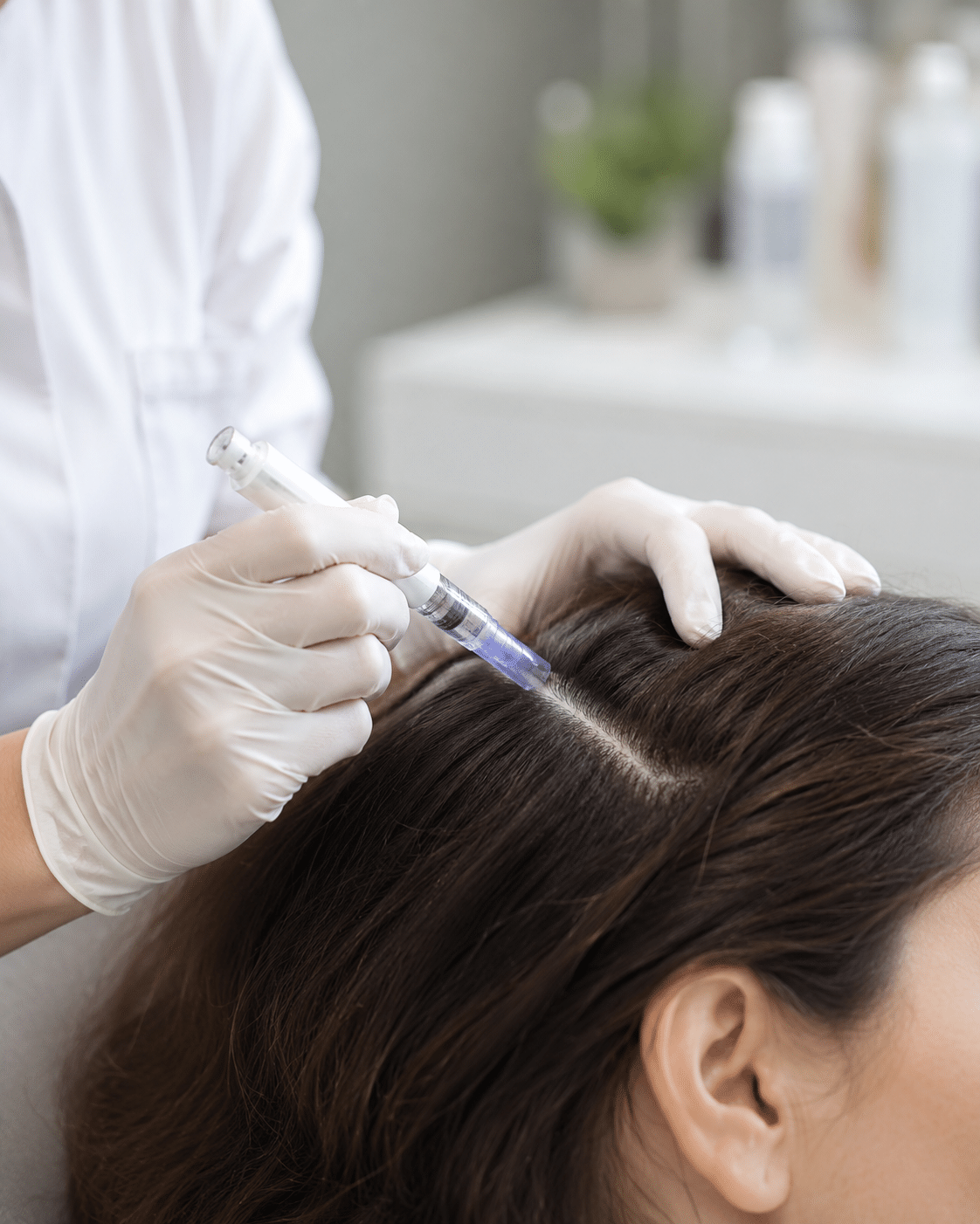 mesoterapia capilar