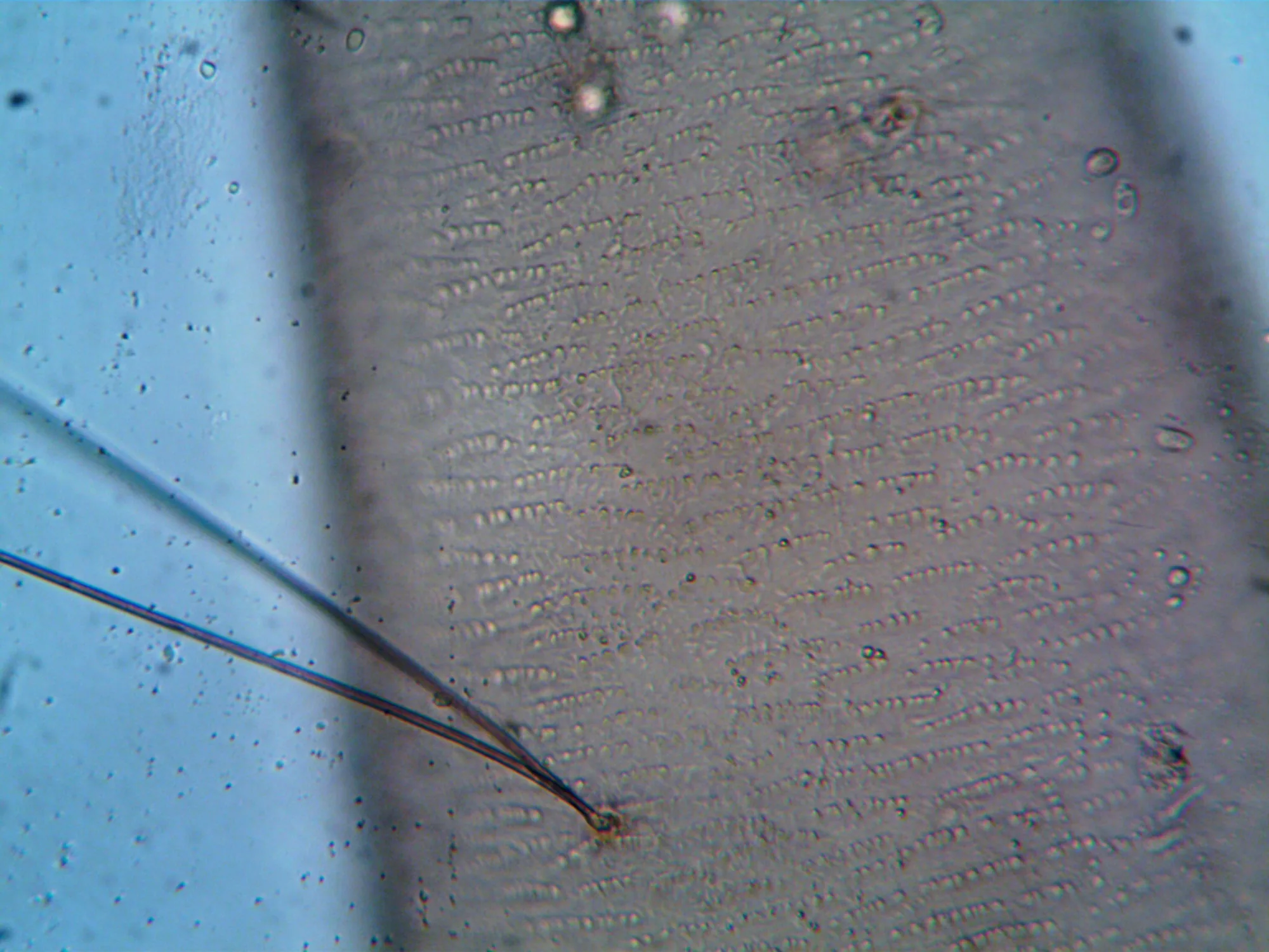 Imagem microscópica ilustrativa de estrutura de folículo capilar.
