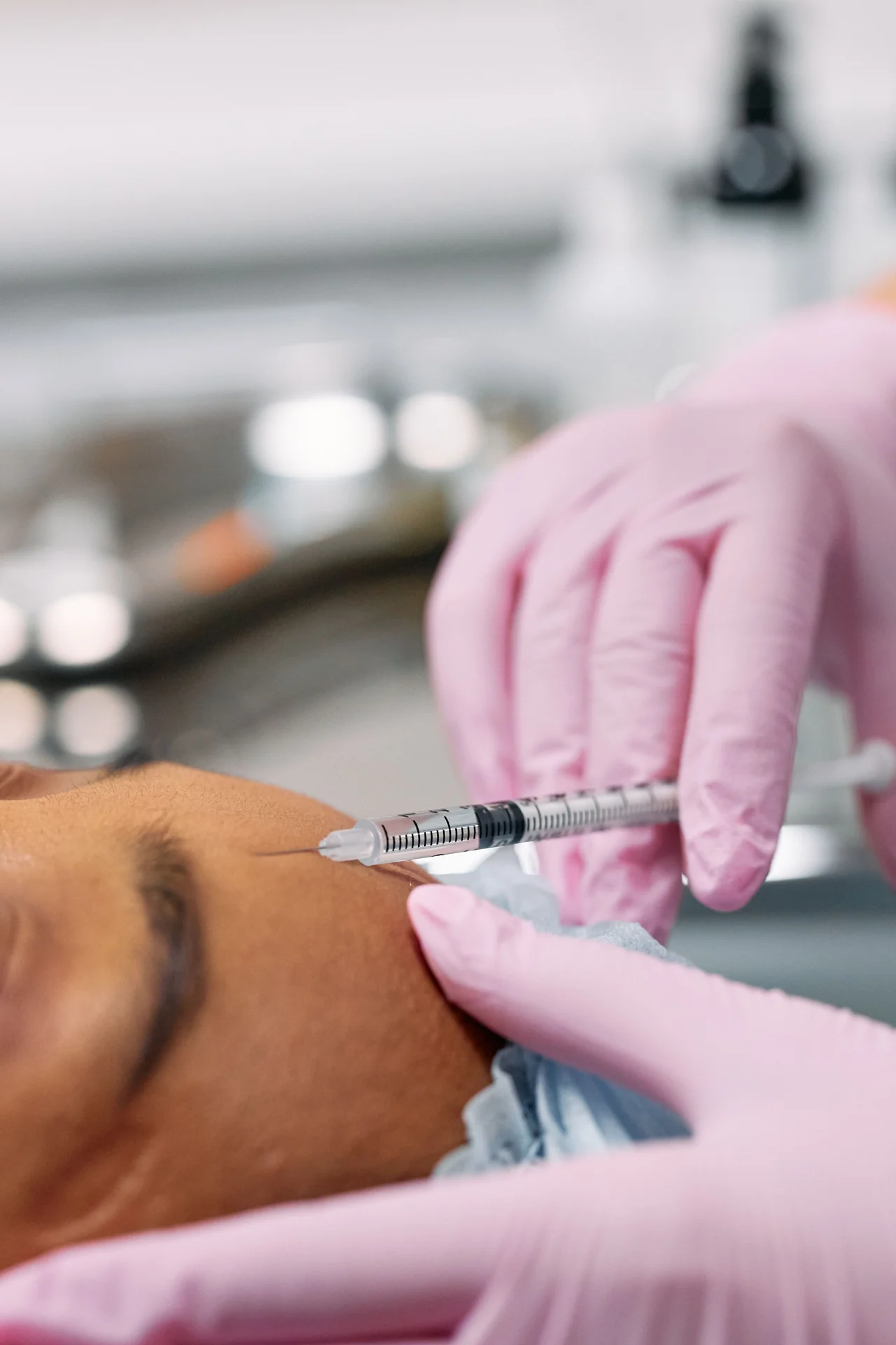 Imagem ilustrativa de seringa próxima à bochecha durante um procedimento facial; produto e técnica não identificados.